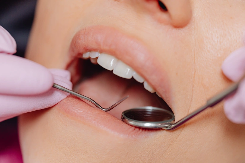 Dental Treatment