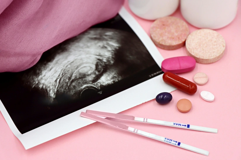 Fertility Treatment